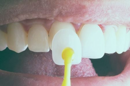 ilustraLentesContato_B